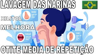 OTITE MÉDIA DE REPETIÇÃO  Lavar as narinas com XILITOL diminui as crises [upl. by Donela]