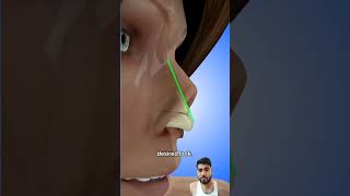 piercing beauty skincare satisfying nose nosejobs rhinoplastycost plasticsurgery rhinoplast [upl. by Namyaw]