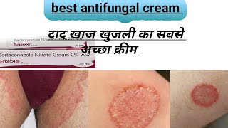 Best and effective antifungal cream दाद खाज खुजली का पक्का इलाज।। antifungal [upl. by Elena]