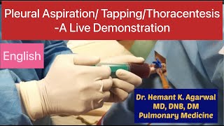 Pleural Aspiration Pleural Tapping Thoracentesis Needle Pleurocentesiss English [upl. by Suckram]