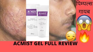 🌈 Acmist Moisturizing Cream Gel Review ByeBye Oily Skin Woes ✨🔥 छुट्टी ओयली त्वचा की चिंता [upl. by Leda986]