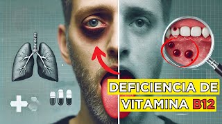 🚨 ¡ALERTA ⚠️ Tu Cuerpo te Está GRITANDO que Necesita VITAMINA B12 🚨 ¡Conoce las 13 SEÑALES [upl. by Viviane943]