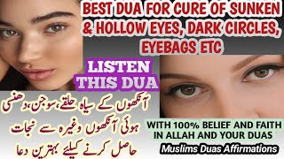 Dua For Dark Circles Under Eyes Dua To Get Rid Of SunkenHollow Eyes Dark Circles Under Eyes Dua [upl. by Denice]