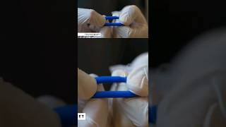 This is how you stop bleeding during nail surgery [upl. by Jeminah822]