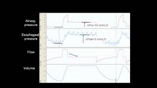 Partitioned compliance of the respiratory system and transpulmonary pressure [upl. by Aisatnaf863]