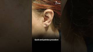 Ear Piercing with Piercing Gun Quick and Painless Procedure shortsviral [upl. by Nitsyrk]