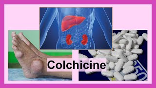 colchicine [upl. by Nnaeinahpets]