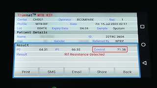 Reading the Results of Truenat MTB and MTB RIF Tests [upl. by Winnah]