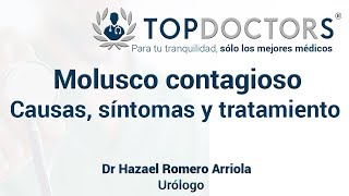 ¿Qué es el molusco contagioso Causas síntomas y tratamiento [upl. by Harberd]