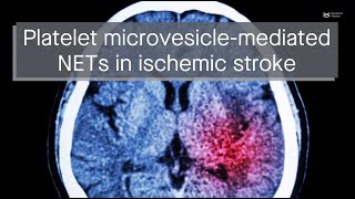 Platelet microvesiclemediated NET formation promotes thrombosis brain injury in ischemic stroke [upl. by Weld]