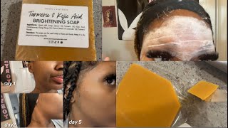 Turmeric amp Kojic Acid Soap From TikTok [upl. by Rebmac]