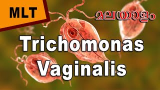 Trichomonas Vaginalis in Malayalam Morphology life cycle and laboratory diagnosis biohub [upl. by Madel64]