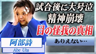 【衝撃】阿部詩が試合中にアクシデント…目の怪我の真相や負けた重圧や責任に精神崩壊した現在に言葉を失う…！『阿部一二三』の妹が五輪の前から抱える怪我や手術の後遺症…語った言葉に一同驚愕！ [upl. by Ahsoyem]