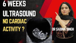 Why Heart Beat Never Comes In Early Pregnancy  6 weeks of pregnancy and ultrasound [upl. by Dearr14]