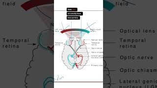 Bitemporal Hemianopia Explained neuroanatomy [upl. by Naek601]