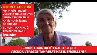 BURUN TIKANIKLIĞI NASIL GEÇER VÜCUDA VERDİĞİ TAHRİBAT NASIL ENGELLENİR [upl. by Anis]