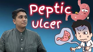 Get rid of PEPTIC ULCERS pepticulcer gastriculcer ulcertreatment homoeopathy [upl. by Cheshire]