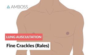 Fine Crackles Rales  Lung Auscultation  Episode 2 [upl. by Nealson]