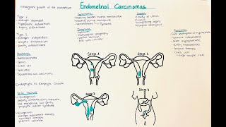 Endometrial Carcinomas  Types Diagnosis Therapy Symptoms [upl. by Olegnaed964]