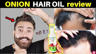 MAMAEARTH ONION HAIR OIL REVIEW  AFTER 1MONTH OF USE  QUALITYMANTRA [upl. by Dumah]