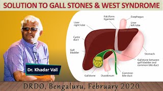 SOLUTION TO GALL STONES amp WEST SYNDROME  Dr Khadar Vali  Biophilians Kitchen [upl. by Francisca234]