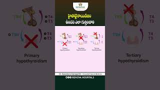 Hypothyroidism Causes and Symptoms  hypothyroidism shorts ytshorts thyroid [upl. by Corso]