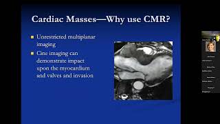 Cardiovascular Magnetic Resonance Imaging of Masses  John D Grizzard MD [upl. by Keelin]