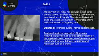 Pulp and Periapical Diagnosis  Endodontics  Radiographic Interpretation [upl. by Shinberg]