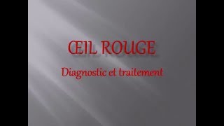 OPHTALMOLOGIE Œil rouge Diagnostic et traitement [upl. by Meridel]