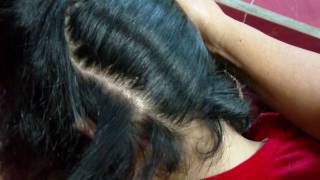 Dandruff Treatment at Home Natural Dandruff Solution Free [upl. by Andrei]