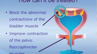 Treatment of Bladder Infections [upl. by Tuesday]