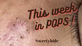 This Week In POPPING [upl. by Tor]