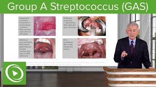 Group A Streptococcus GAS – Infectious Diseases  Lecturio [upl. by Susy]