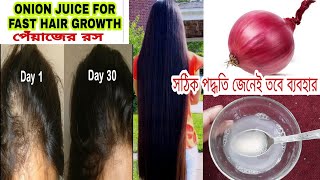 পেঁয়াজ রস100Hair Growthচুল পড়া বন্ধ করে ও নতুন চুল গজায়Onion Juice and coconut oil no hairfall [upl. by Peggy111]