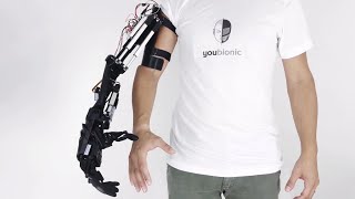 Youbionic Arm [upl. by Evanthe]