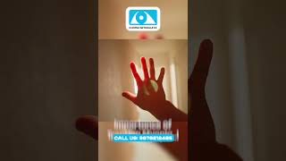 Myopia Symptoms Causes and Treatment Options  Chopra Nethralaya  Best Eye hospital Ludhiana [upl. by Ahsiema]