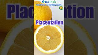 Placentation  Types of Placentation  Morphology of Flowering Plants  NEET  Class 11 Biology [upl. by Firahs642]