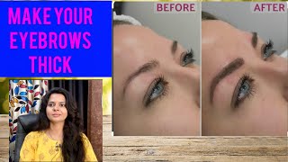 Make your EYEBROWS THICK आईब्रो कैसेघनी करे Eyebrow hairlossTreatment alopecia of eyebrow docto [upl. by Icrad]