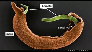 Trematoda 3 Schistosoma [upl. by Jordison]