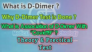 D Dimer Test Theory and Prectical Finecare  D  Dimer Association With Covid19 Infection [upl. by Nelson756]