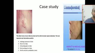 Case 70 teratogenic medication isotretinoin embryopathy retonic acid induced microtia Anotia TGA [upl. by Eldridge]