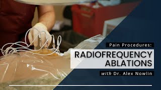 Radiofrequency Ablations What You Should Know [upl. by Darrelle]