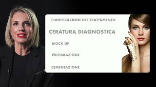 Ceratura diagnostica MockUp e preparazioni per faccette dentali [upl. by Aihsinyt542]