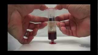 Biologics  PRP  ACP extraction syringe [upl. by Enneira]