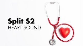 Fixed Split S2  Heart Sounds  MEDZCOOL [upl. by Saks]