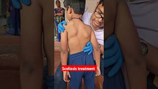 Scoliosis treatment drrajneeshkant worldfamouschiropractor [upl. by Anerrol]