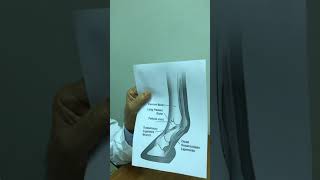 مفصل المعقم في الخيل affection of fetlock joint in horse [upl. by Fong]