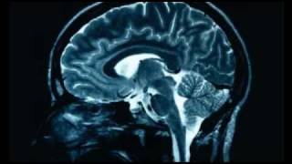 Why Religion causes brain damage [upl. by Fronniah]