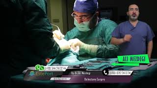 Buccal Fat Pad Removal Procedure Bichectomy Surgery [upl. by Ahsilra]