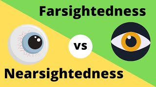 Difference between Myopia  Near Sightedness and Hyperopia  FarSightedness [upl. by Casi585]